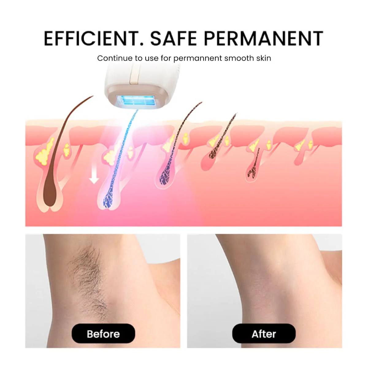 AMIRO IceSmooth Hair Removal IPL Device - Image 4