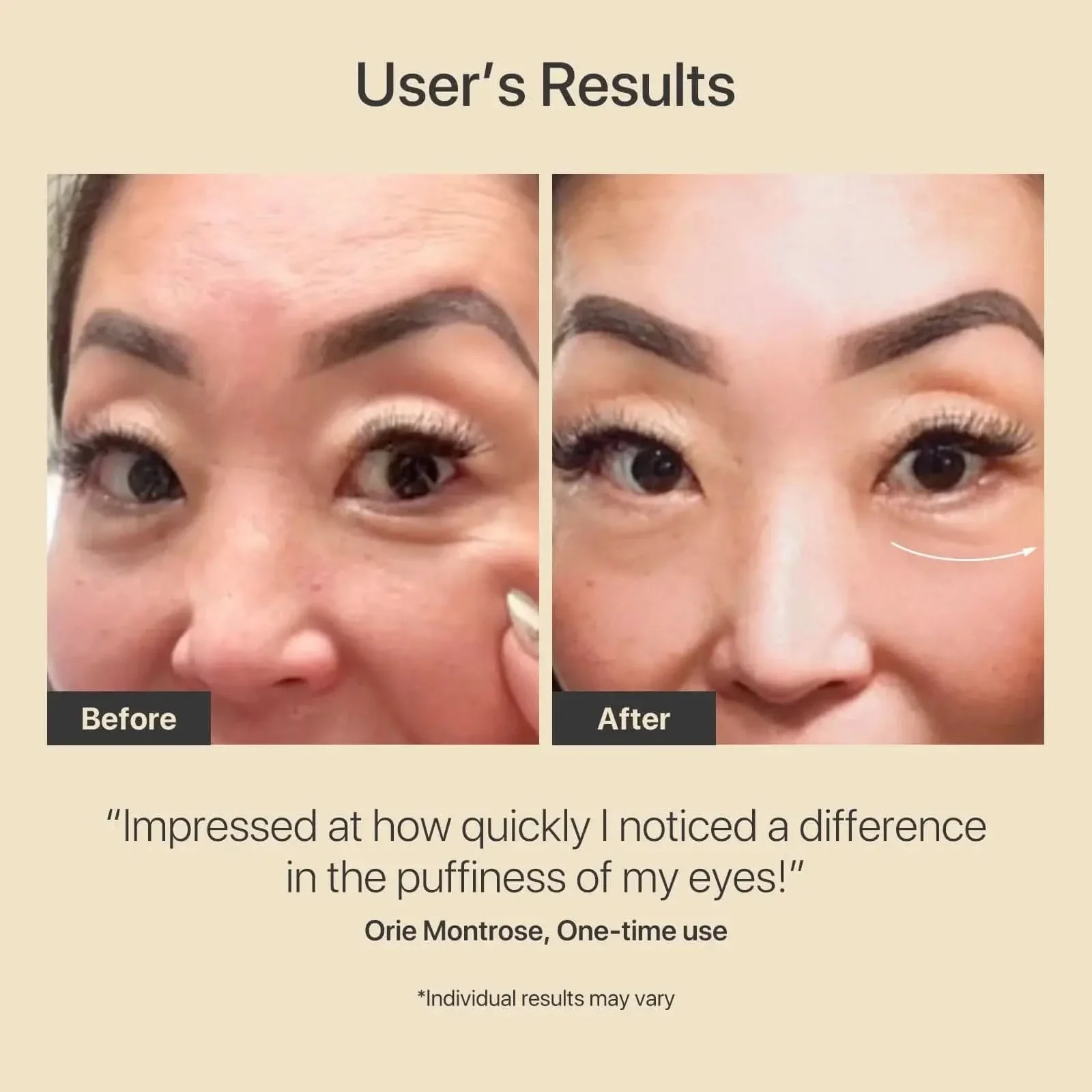 AMIRO R3 Turbo Facial RF Beauty Tool - Image 3