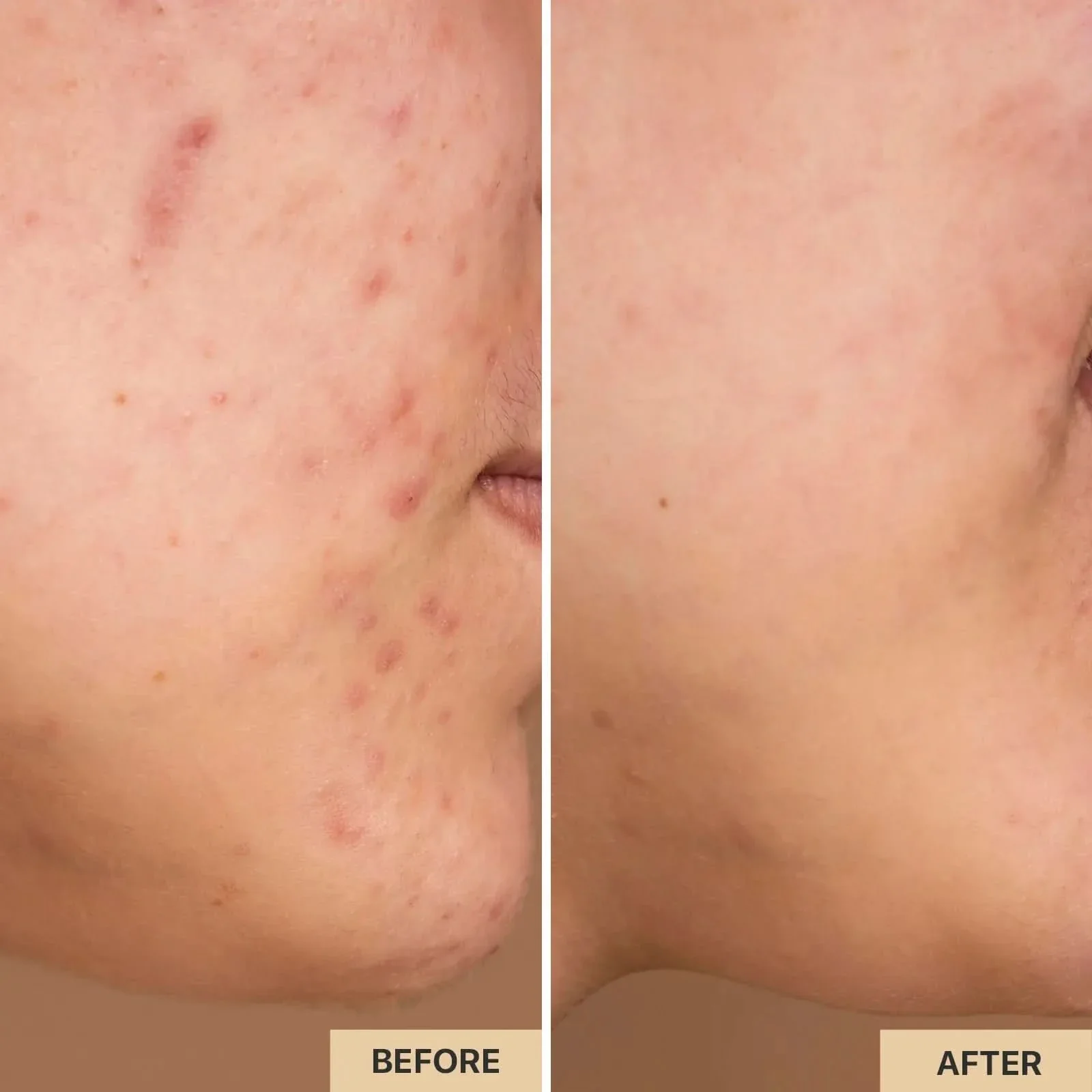 [Tati’s Exclusive] AMIRO Spectra 5-in-1 LED Face Mask - Image 7