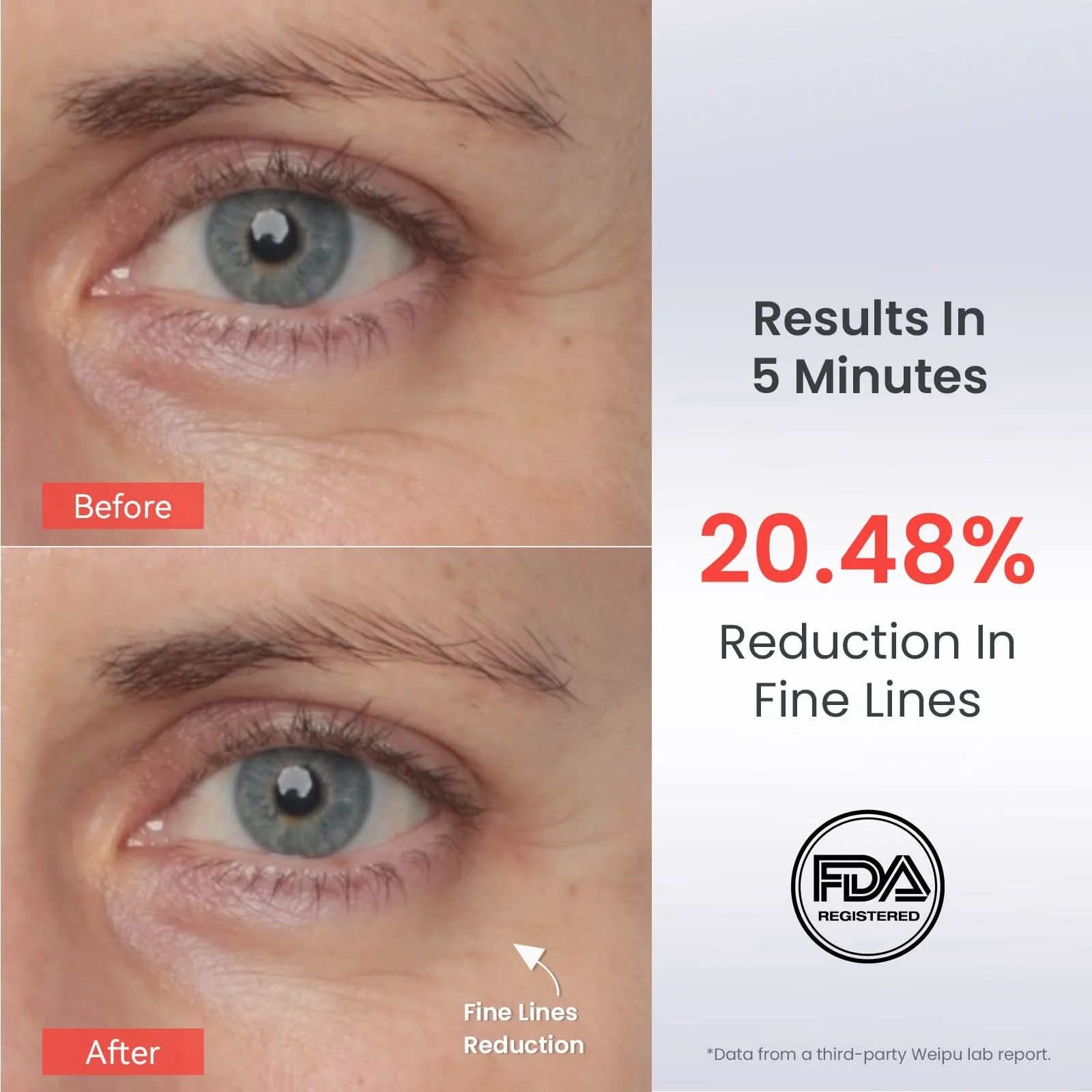 AMIRO EyeGlow Red Light & Microcurrent Eye Cream - Image 4
